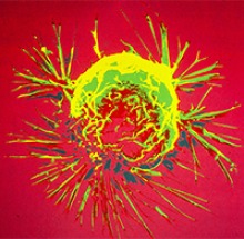 A breast cancer cell photographed by a scanning electron microscope, as illustrated here, can show how cells respond in changing environments and can show mapping distribution of binding sites of hormones and other biological molecules. (Image: Bruce Wetzel and Harry Schaefer/National Cancer Institute)