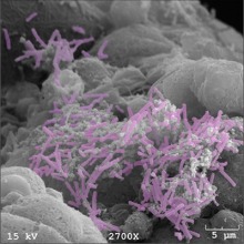 Endometrial cells colonized with “good” bacteria called Lactobacillus crispatus (colored purple). Image courtesy of the Herbst-Kralovetz Lab