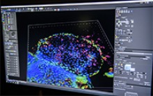 Imaging shows H. pylori infection in gastric organoids, which are miniature organs with realistic microanatomy that were developed in a lab from tissue samples.